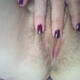 Pelo e unghie